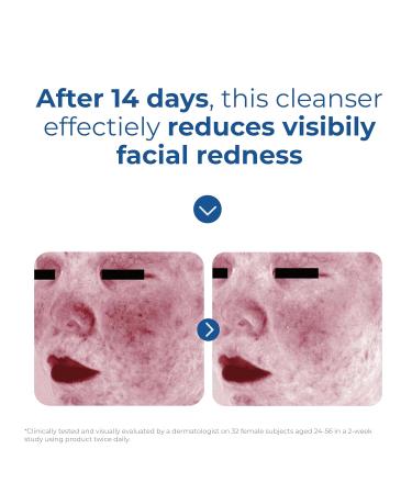 EltaMD Skin Recovery Amino Acid Foaming Cleanser Gentle Face Cleanser for Sensitive Skin Proven to Gently Remove Makeup and Sunscreen Fragrance Free and Noncomedogenic Foaming Face Wash 5 oz - Buy Online on GoSupps.com