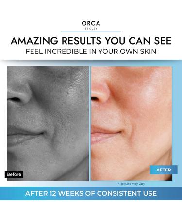 Glycolic Acid Face Serum 2oz - 15% AHA Complex with Hyaluronic Acid - Anti Aging & Skin Brightening Serum - Buy Online on GoSupps.com
