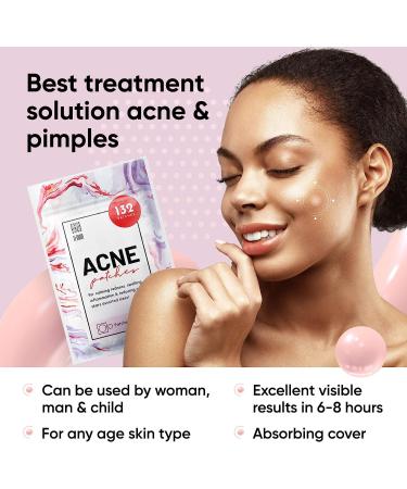 LE GUSHE Acne Patches 132 Dots | 3 Sizes 8mm, 10mm, 12mm | Hydrocolloid Pimple Blemish Treatment - Buy Online on GoSupps.com