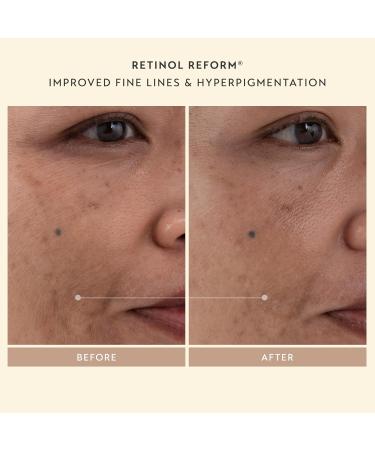 SHANI DARDEN SKINCARE Sculpt & Firm Travel Kit - Facial Sculpting Wand Retinol Reform Lactic Serums & Peptide Cream - 7 Essential Items for Radiant Skin - Buy Online on GoSupps.com