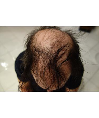 Hair Building Fibers Soft Black - 25g Refill | Finally Hair - Premium Quality for Thicker Hair - Buy Online on GoSupps.com