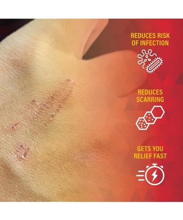 Scar Zone Burn Pain Relief Gel - Extra Strength Topical Analgesic for Minor Cuts, Burns & Abrasions (0.5 oz) - Buy Online on GoSupps.com