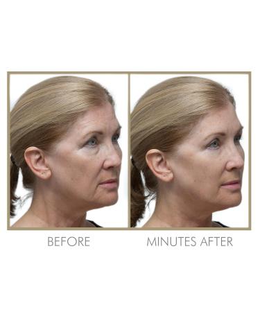 GENIE Instant Line Smoother (30 ml/1 fl oz) 1 Fl Oz (Pack of 1) - Buy Online on GoSupps.com