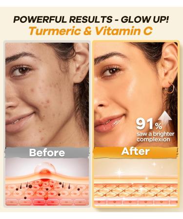 Revitalizing Exfoliation Face Scrub with Vitamin C and Turmeric Gentle Exfoliating Face Wash for Blackheads Pore Dirt & Dark Spots Acne Control Facial Scrub for Oily & Acne-Prone Skin 4.23 Fl Oz - Buy Online on GoSupps.com
