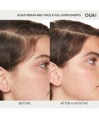 OUAI Scalp & Hair Treatment Bundle Serum - 2 Fl Oz. -  and Masque for Moisturized - 8 Fl Oz. - Buy Online on GoSupps.com