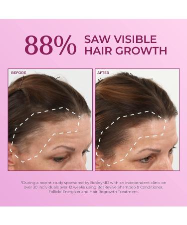 BosleyMD Extra Strength 2%-5% Thinning Hair Treatment Foam 2oz for Men and Women - Hair Loss & Regrowth Solution - Buy Online on GoSupps.com