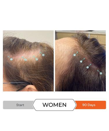 Revita Volumizing Conditioner for Thinning Hair - Hair Growth Support for Men and Women - Hair Thickening and Strengthening - Sulfate Free - 31 fl oz - Buy Online on GoSupps.com