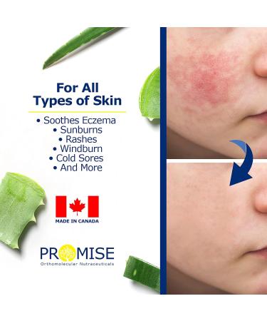 Promise Organic Aloe Vera Gel 340ml (12oz) for Face Hair and Skin- Pure Aloe Vera Juice for Moisturizing Skincare After Sun Lotion For Sunburn Relief Keep Skin Healthy and Hydrated All Year Long 340 ml (Pack of 1) - Buy Online on GoSupps.com