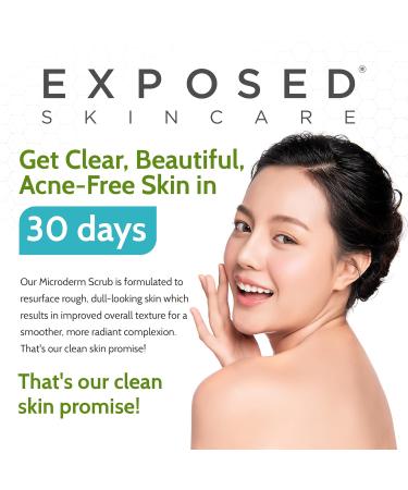 Exposed Skin Care Microderm Face Scrub - Exfoliate Acne Scars Blackheads & Fine Lines | Smooth Glowing Skin - 1.7 Fl Oz - Buy Online on GoSupps.com