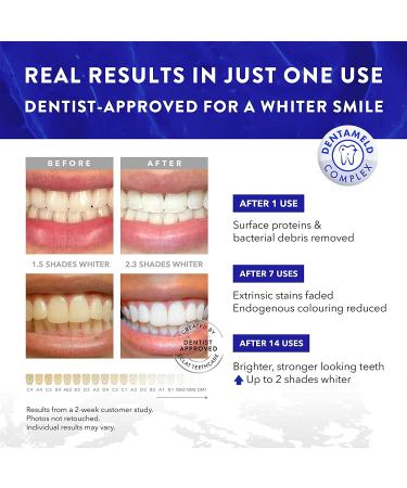 Teeth Whitening Strips - DentaMeld Technology for 3X Whiter Teeth - Sensitive Teeth Kit by UK Dentists - Buy Online on GoSupps.com