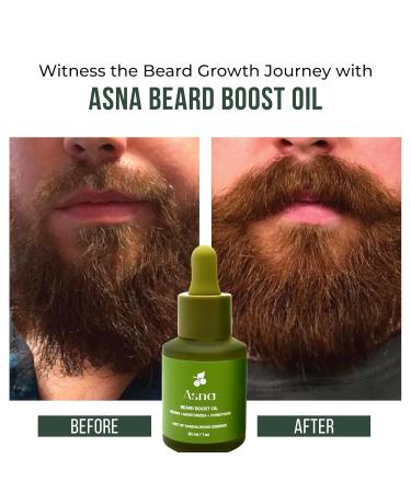 Asna Beard Boost Oil | Cold-Pressed Ayurvedic Formula for Nourishing & Moisturizing All Hair Types | Stimulates Growth with Vitamin C & Antioxidants - Buy Online on GoSupps.com