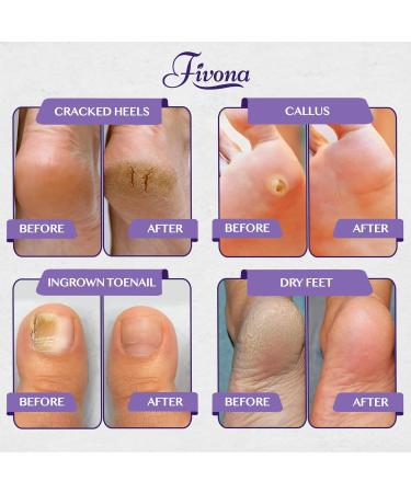 Fivona Lavender Foot Soak Blend - Calming Epsom Salt for Tired Feet Soothe Soreness & Rejuvenate Pedicure Spa at Home (14.1 oz - Buy Online on GoSupps.com