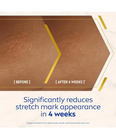 NIVEA Luminous 630 Anti Stretch Marks & Dark Spots Body Cream (200ml) 48-Hour Moisturising Cream Reduces Stretch Marks Sun Blemishes and Pigment Spots Body Lotion - Buy Online on GoSupps.com