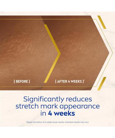 NIVEA Luminous 630 Body Oil Serum Anti Stretch Marks (100ml) Skincare Serum with Luminous 630 Visibly Reduces Stretch Marks in 2 weeks Starts Working From Day 1 - Buy Online on GoSupps.com