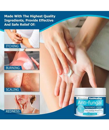 Roycederm Antifungal Cream - Maximum Strength Treatment for Athletes Foot, Eczema, Psoriasis, Jock Itch, Rash, Ringworm & Skin Yeast Infection - Buy Online on GoSupps.com