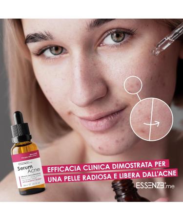 Essenze.me Pure Elegant Wellbeing Acne and Pimples Face Serum Essences Anti-Acne Treatment Immediate Effect Eliminates Pimples and Imperfections Dermatologically Tested Formula Results in 7 Days - Buy Online on GoSupps.com