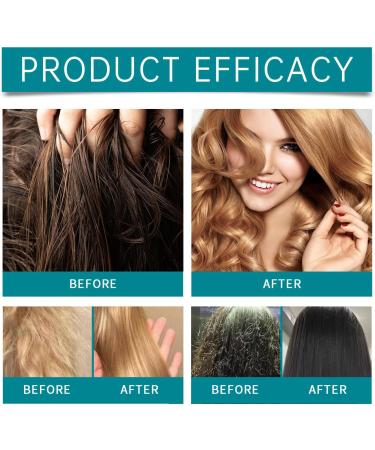  XINRAN rosemary shampoo stronger hair structure rosemary hair growth oil exfoliating scalp shampoo cooling oil non greasy oil growth oils - Buy Online on GoSupps.com