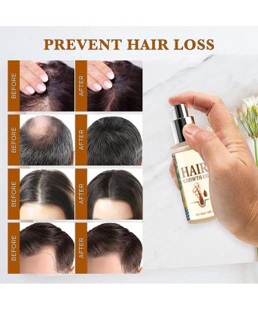  GjnjfdF Natural Hair Growth Oil | 50ml Strengthening and Thickening Natural Hair Oil | Beauty Treatment for Scalp Texturizing Routine Daily Use Blow Drying and Styling - Buy Online on GoSupps.com