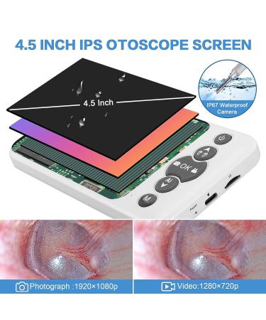 AI Intelligent Visual Digital Otoscope Hiacinto | Ear Wax Removal Tool 4.5 IPS Screen Camera | Gyroscope & Recording | 32GB Card & Cleaning Kits - Buy Online on GoSupps.com