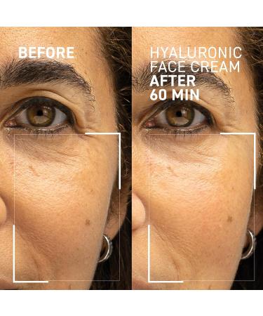 Buy Needles No More Hyaluronic Face Cream - Best Plumping Hydrator for Dry Skin - 1.7 oz International Shipping - Buy Online on GoSupps.com