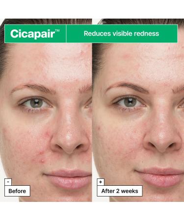 Dr.Jart+ Cicapair Soothing Face Treatment | Korean Skin Care for Irritated Skin | Skin Barrier Repair | 1.01 fl oz - International Shipping Available - Buy Online on GoSupps.com