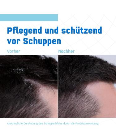  Terzolin Terzolin Expert Shampoo for dry scalp hair care anti-dandruff for dry dandruff and eczema with postbiotic and allantoin 200 ml - Buy Online on GoSupps.com