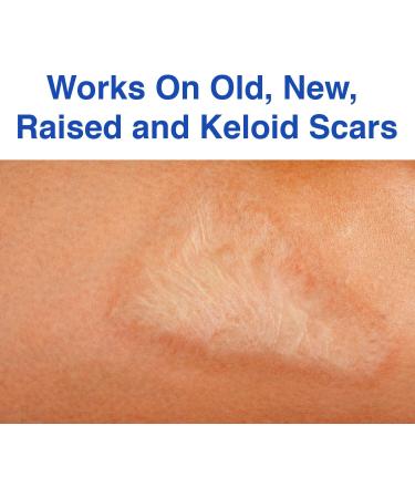 Clear Skin Scar & Bruise Cream - Model Series - Buy Online on GoSupps.com