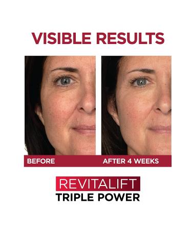 L'Oreal Paris Revitalift Triple Power Anti-Aging Face Moisturizer | Pro Retinol, Hyaluronic Acid, Vitamin C | Reduce Wrinkles, Firm & Brighten Skin | 2.55 oz - Buy Online on GoSupps.com