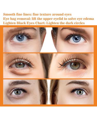 Turmeric + Vitamin C Eye Cream - Dark Circle Remover & Anti-Aging Brightening Treatment for Eyes | 30g - Buy Online on GoSupps.com