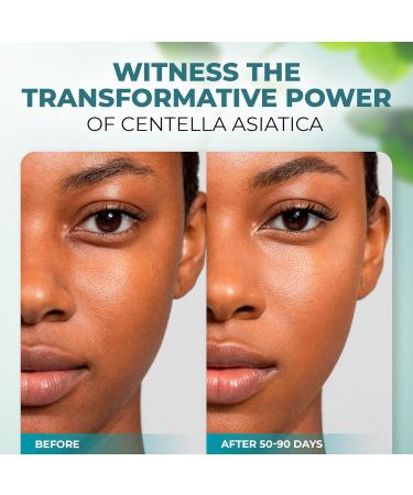 Centella Asiatica Face Serum - Natural Calming Moisturizer with Niacinamide & Hyaluronic Acid | International Shipping Available - Buy Online on GoSupps.com