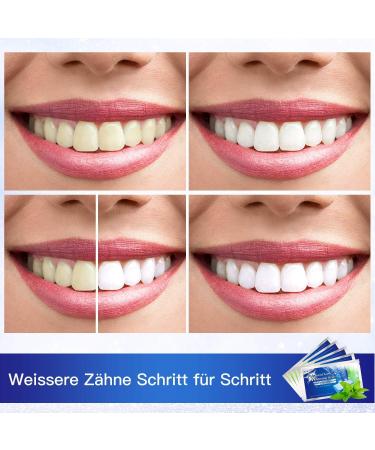 Fast & Painless 28 White Strips Teeth Whitening Kit - Home Bleaching for Bright Smiles - Buy Online on GoSupps.com