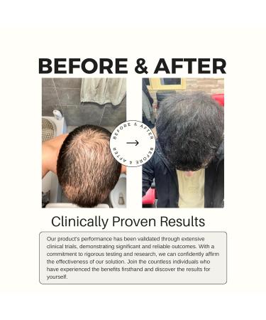 Hair Growth Spray for Thinning Hair - Regrowth Treatment for Men & Women with Castor Rosemary & Argan Oil - Strengthens & Thickens - Made in USA - 4 Fl Oz - Buy Online on GoSupps.com