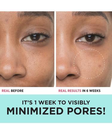 IT Cosmetics Bye Bye Pores 10% Glycolic Acid Serum - Pore-Minimizing & Exfoliating Serum with Hyaluronic Acid - Vegan Formula - 1 fl oz - Buy Online on GoSupps.com