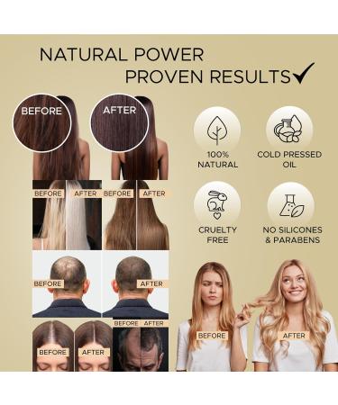 Prima Qualitas Hair Growth Oil with Rosemary Oil Caffeine Biotin Castor Oil Jojoba Oil Grape Seed Oil -Thicken Hair Treat Dry Damaged Hair and Split Ends Target Hair Loss Natural 100 ml - Buy Online on GoSupps.com
