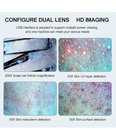 Hair Follicle Detector 11 Inch 200X High-Definition Skin Detector 1080P Imaging Used to Detect the Health Status of Scalp Hair Follicles and Skin - Buy Online on GoSupps.com
