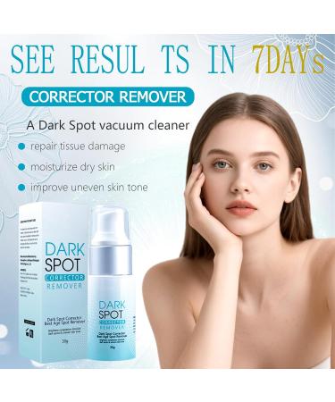 Dark Spot Remover for Face Body - Dark Spot Corrector Cream for Sun Spots Skin Brown Spots Melasma Skin Lightening Cream for Women and Men (1.0 Fl Oz) White - Buy Online on GoSupps.com