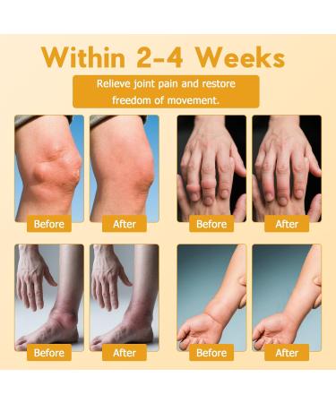 Loicwoo Magnesium Oil & Bee Venom Joint Spray Magnesium Spray Magnesium Joint Sprays for Relax Muscle Joints Bee Venom Sprays for Back Knee Hands Neck (1 PCS 100ML) - Buy Online on GoSupps.com