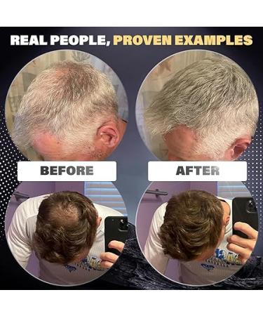 Dark Brown Hair Building Fibers for Men - Conceal Hair Loss  Bald Spots - 100% Natural & Undetectable - 2 Month Supply - Buy Online on GoSupps.com