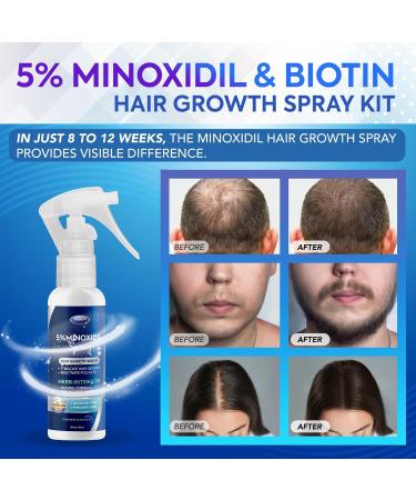 5% Minoxidil Hair Regrowth Treatment for Men & Women - 60ml Spray for Hair & Beard Growth - Buy Online on GoSupps.com