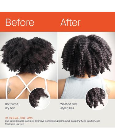 Buy Clarifying Detox Shampoo - Removes Dirt & Buildup Glycolic & Salicylic Acid for Curly & 4C Hair - Silicone-Free - Buy Online on GoSupps.com