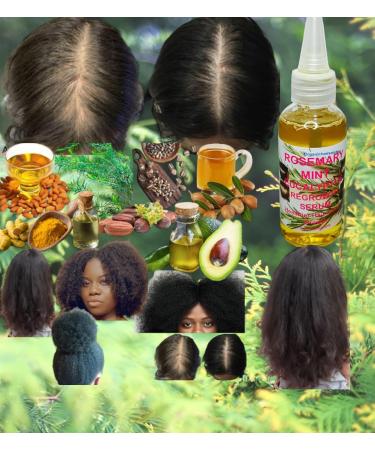 Rosemary Mint Eucalyptus Hair Oil | Thicker Longer & Fuller Hair | Nourishes Split Ends & Dry Scalp - 2 fl oz - Buy Online on GoSupps.com