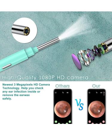 QDCFY OTOSKOK Wireless Endoscopic Camera - Ear Wax Removal Tool with LED for iPhone iPad & Android - Black & Pink - Buy Online on GoSupps.com
