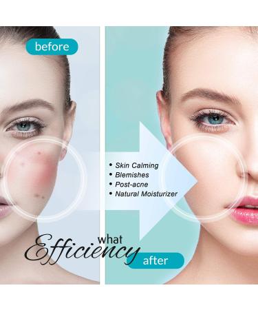 100% Pure Blue Tansy Facial Oil | Carenology Overnight Repair for Acne & Scars | Non-Greasy Dermatologist Recommended Skincare for All Skin Types - Buy Online on GoSupps.com