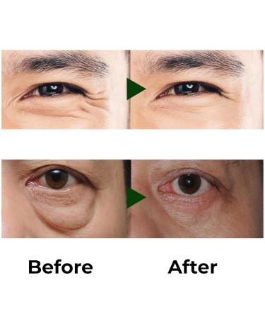 Abera Eye Roller Serum with Mint Essence & Vitamin C Reduces Dark Circles Puffiness & Fine Lines - 0.34 fl oz - Buy Online on GoSupps.com