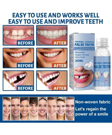 Tooth Filling Repair Kit for Temporary and Broken Teeth - Dental Repair Beads for Dentures and False Teeth - Buy Online on GoSupps.com