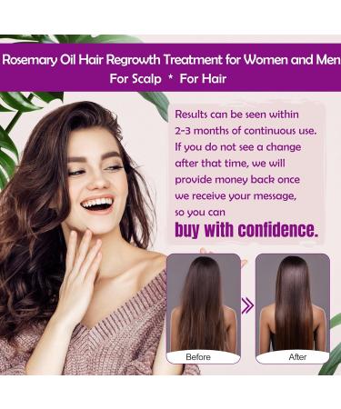 Rosemary Oil Hair Growth Serum & Biotin - Castor Oil Conditioner for Thinning Hair | Improve Volume & Thickness - Buy Online on GoSupps.com