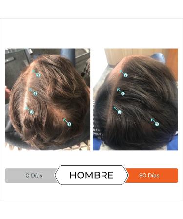 Revita Volumizing Shampoo for Thinning Hair - Supports Hair Growth, Strengthens and Thickens Hair - Sulfate Free, DHT Blocker - 31 Fl Oz - Buy Online on GoSupps.com