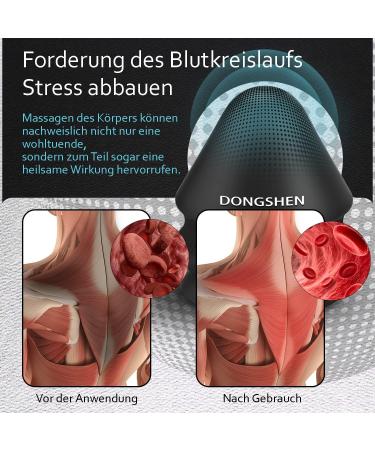 Dongshen Triggerpunkt Presser - Fascia & Massage Ball with Suction Cup for Muscle Pain Relief | Perfect for Shoulders Neck Back & Legs - Black - Buy Online on GoSupps.com