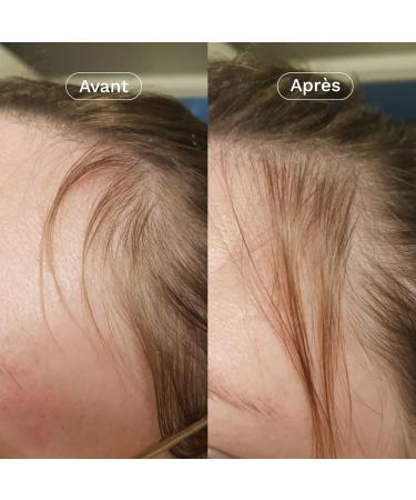 OMUM - In&Out Hair Duo Gift Box: 1 Organic Boost Lotion + 1 Anti-Hair Loss Food Supplement - Stimulates hair growth strengthens from 45 days - Natural France Vegan - Buy Online on GoSupps.com