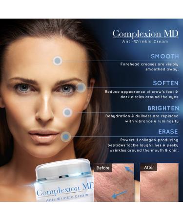Complexion MD Anti Aging 2 Step Skin Care System (Bundle) - Microdermabrasion Scrub (1.69 oz) + Anti Wrinkle Cream (1 oz) - Reduce Fine Lines & Wrinkles - with Peptides & Hyaluronic Acid - Buy Online on GoSupps.com